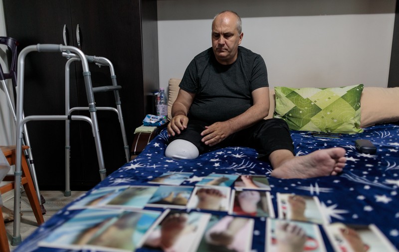 Rămas fără un picior după COVID, un bărbat îi acuză de neglijență pe medicii infecționiști de la spitalul din Slatina