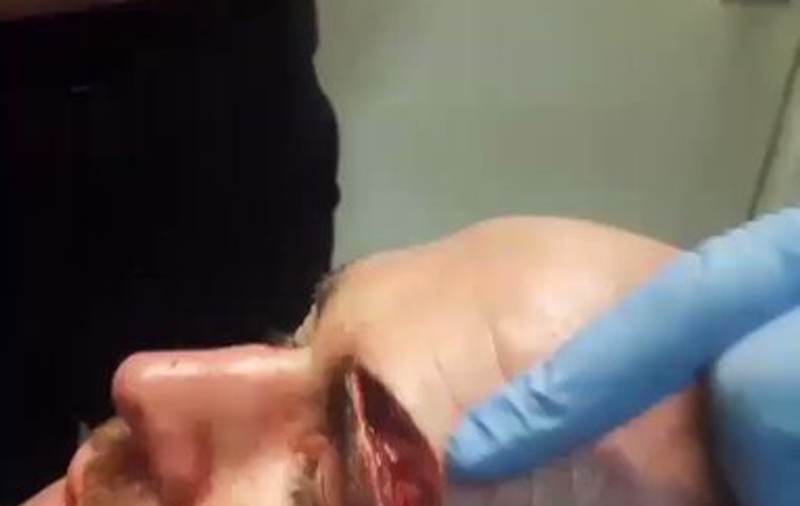 Cea mai oribilă accidentare din sport. Așa arăta Jack Mason, după un meci de MMA! | FOTO&VIDEO