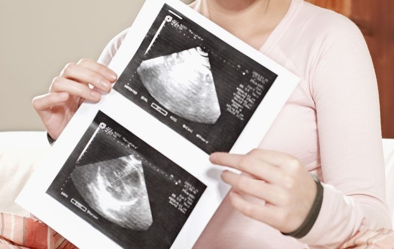 11.000 de euro un nou-născut, în Mexic