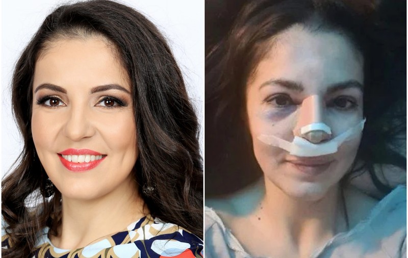 Cristina Joia de la „Visuri la cheie”, la nouă luni de când a fost agresată: „În România poți mutila pe oricine și nu pățești nimic”