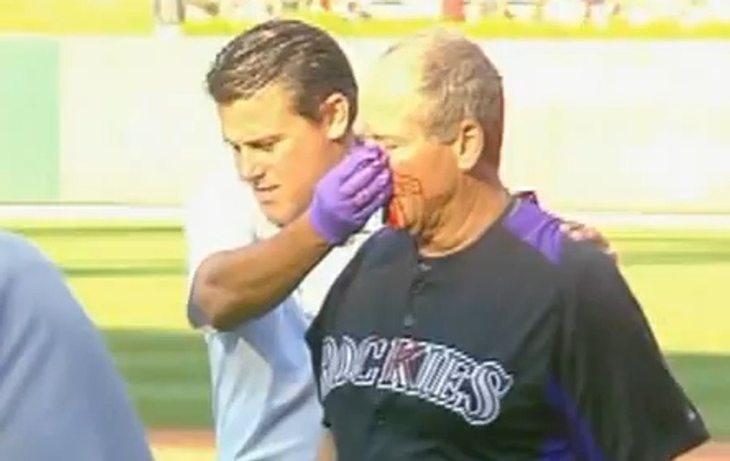 Video | Antrenor de baseball, lovit în faţă de o minge, în direct