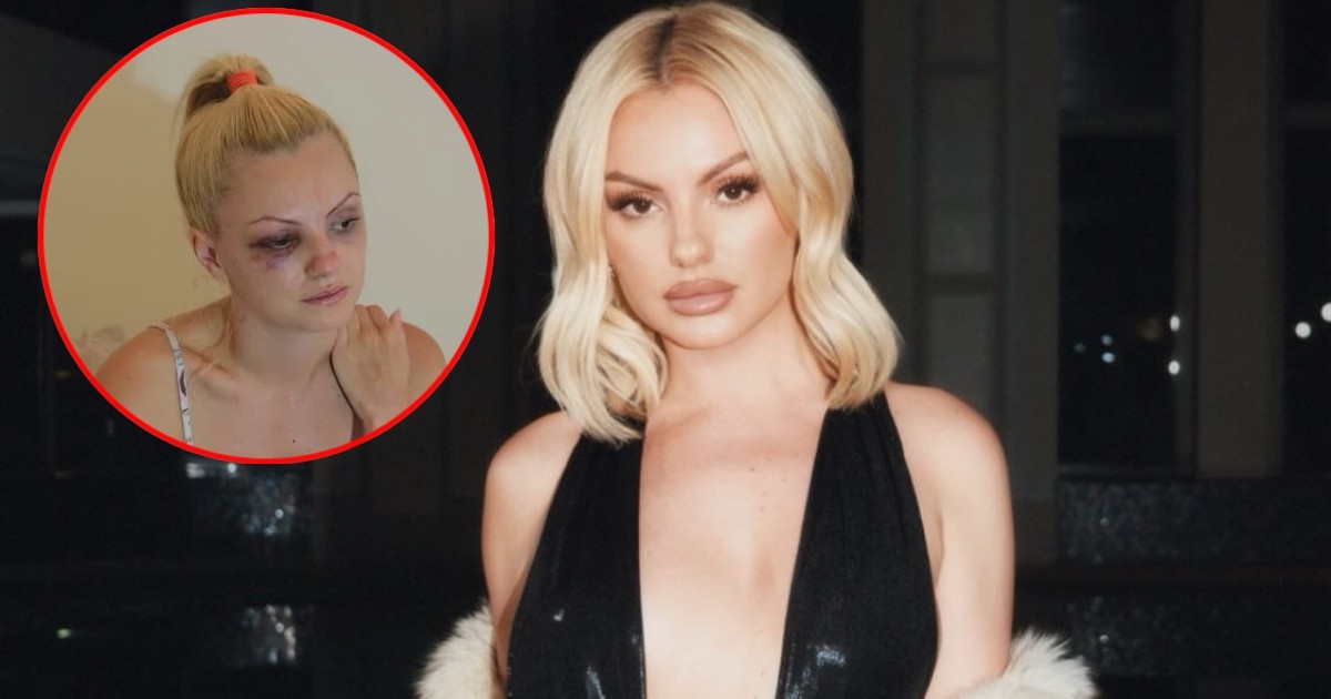 Alexandra Stan