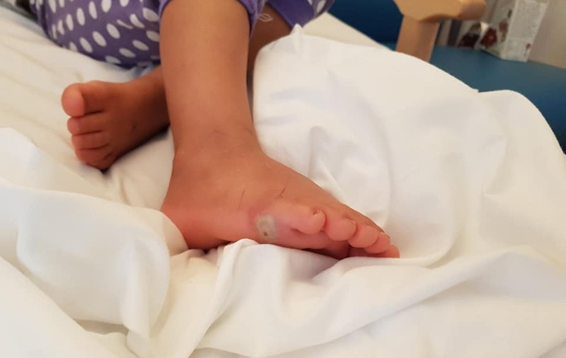 FOTO | O fetiță a făcut septicemie de la o bacterie pe care a luat-o probând o pereche de pantofi