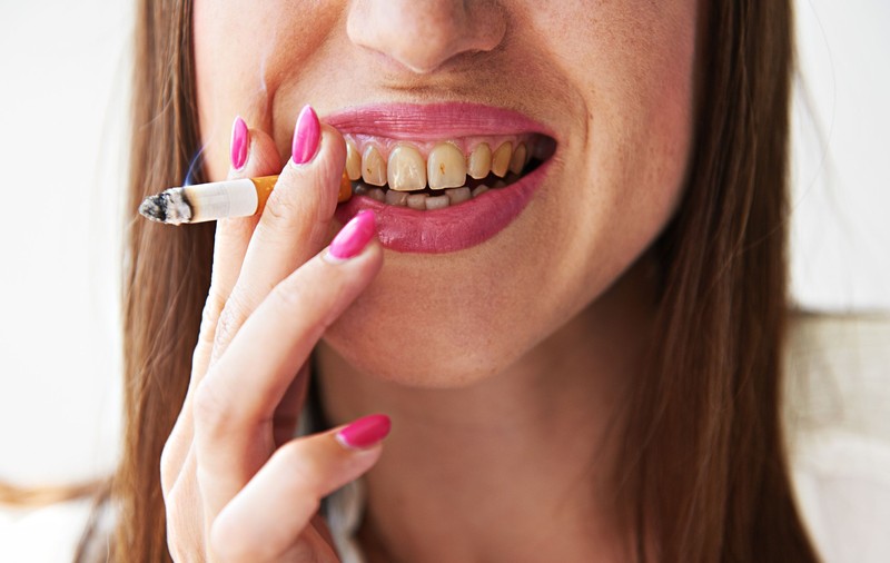 Cât de mult atacă fumatul dinții și gingiile? Specialistul ne răspunde