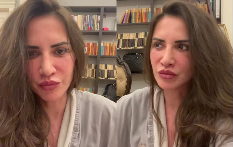 Mara Bănică, primele declarații după intervenția estetică de 15.000 de euro: „Asta e fața mea încă bombardată, un pic umflată”