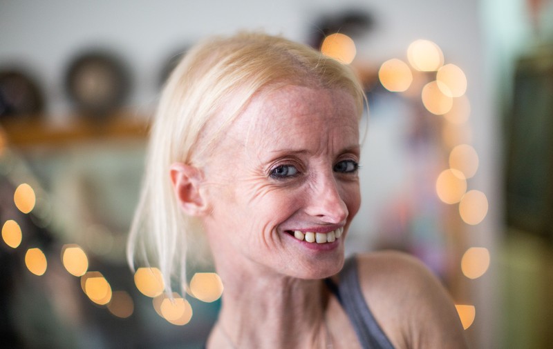 Povestea femeii care îmbătrânește de opt ori mai repede decât în ​​mod normal. Medicii îi dădeau 12 ani de viață, iar acum are 41