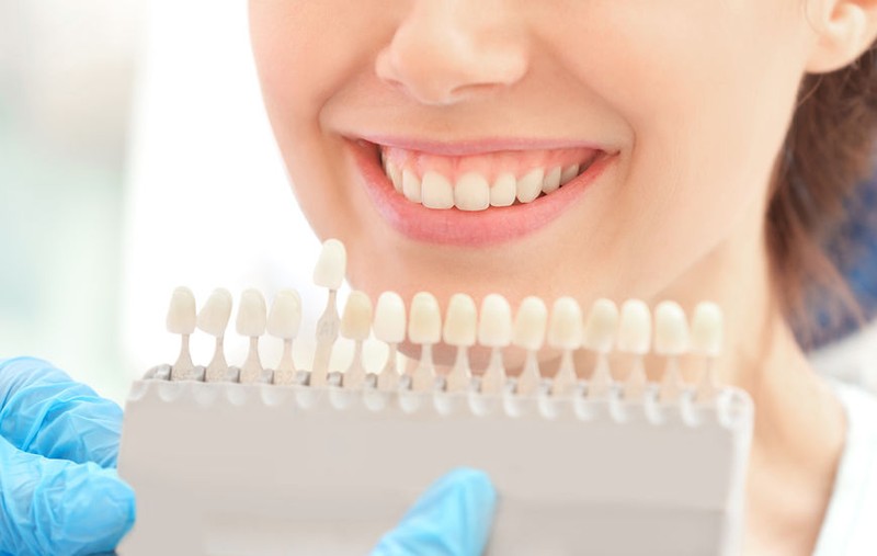 Fatete dentare
