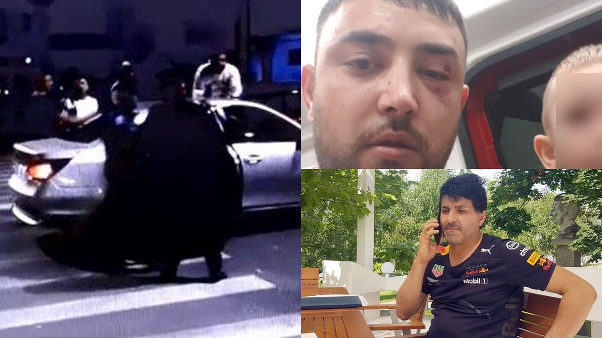 Scandal în Caracal! Un bărbat susține că ar fi fost bătut de bodyguarzii lui Remus Rădoi