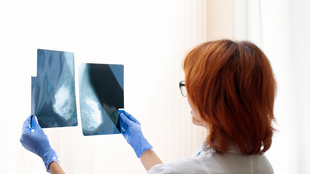 Ca să fim la nivelul Uniunii Europene, unde 66% din populația feminină între 50 și 69 de ani își fac screening anual prin mamografii, ar însemna ca 1,6 milioane de românce să-și facă an de an această investigație