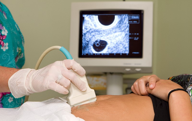 Pandemia e și a femeilor pe care statul le obligă să nască împotriva voinței lor. Doar 11% din spitalele din România mai fac avorturi la cerere. În București, nici unul