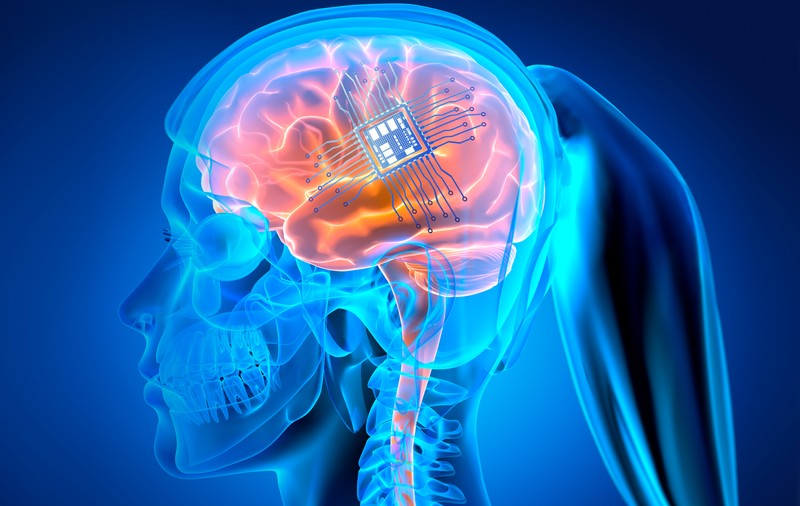 Medicii i-au scos implantul cerebral împotriva voinței sale. „Aș fi dat orice să-l păstrez”
