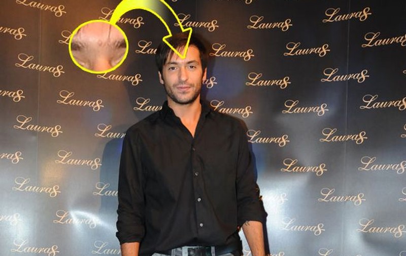 De necrezut! Radu Vâlcan îşi ascunde un semn distinctiv de pe faţă cu ajutorul Photoshop-ului. Vezi despre ce e vorba!