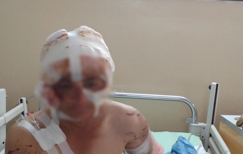 Femeie mutilată pe viaţă de câini! Uite cum arată! FOTO