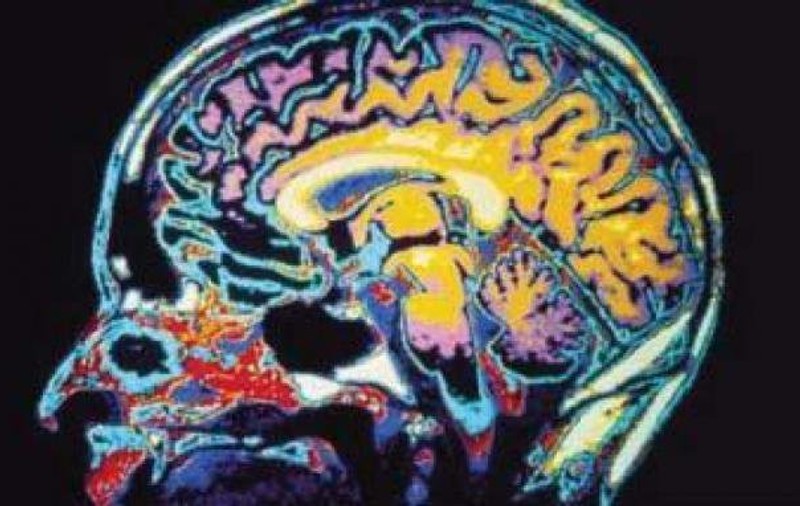 Controversă etică în lumea medicală, după ce fragmente de creier uman au fost implantate cu succes la șoareci