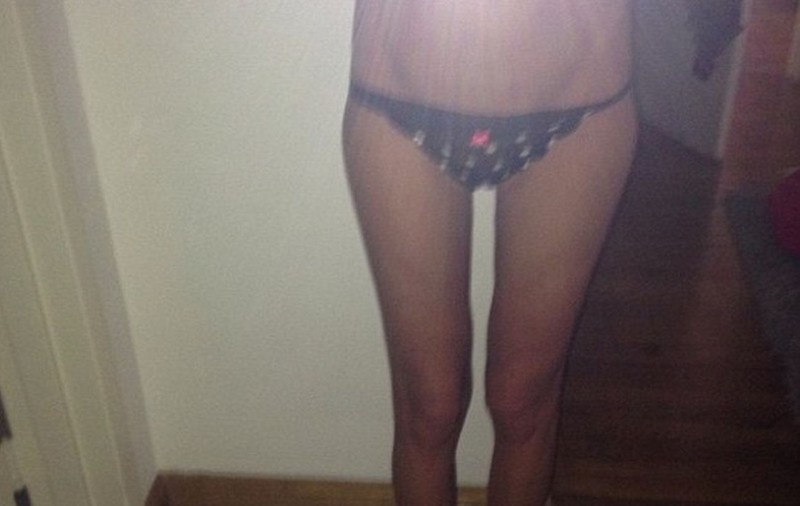 O VEDETĂ a ajuns ÎN ULTIMUL HAL DE SLABĂ! Vezi cine este ANOREXICA! FOTO