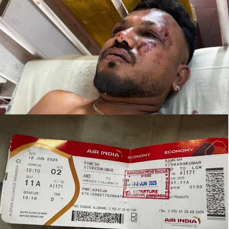 Bărbatul care a supraviețuit miraculos prăbușirii avionului în India. Foto: X /NEXTA