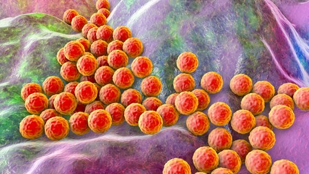 Spitalul s-a apărat spunând că „stafilococul auriu e o bacterie care se întâlnește în mod normal în organismul uman”. Foto: imagine ilustrativă cu bacteria MRSA via Shutterstock