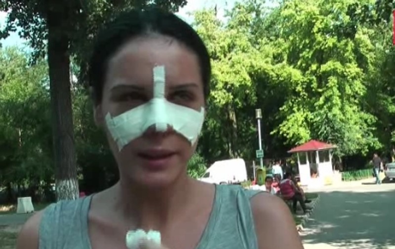 Video | Sosia Adelinei Pestriţu a ieşit la agăţat cu nasul bandajat