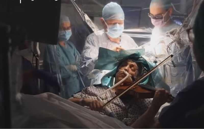 O femeie a cântat la vioară în timp ce doctorii îi scoteau o tumoare din creier
