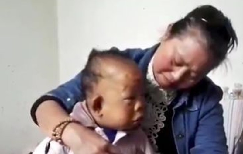 Povestea bărbatului de 30 de ani care arată ca un bebeluș. Nu a mai crescut de la vârsta de 2 ani | VIDEO