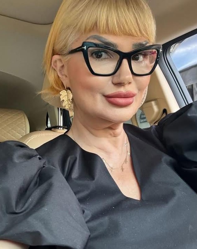 Transformarea Ozanei Barabancea, la o lună după operația de lifting facial