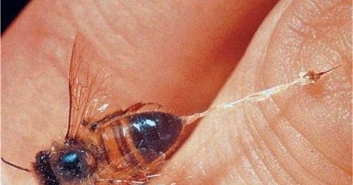 Copil înțepat de o insectă, în Iași în șoc anafilactic. Este transportat la spital cu elicopterul