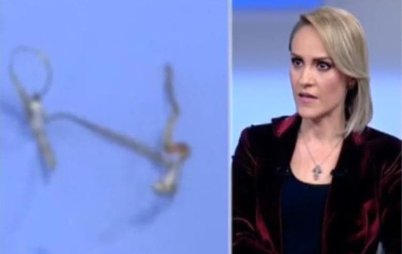 Gabriela Firea a prezentat fotografii cu sârma găsită de medici în colonul său. "Vom închide acest subiect"