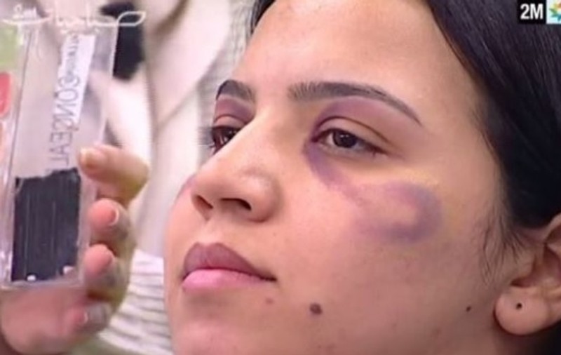 O televiziune din Maroc le-a arătat femeilor cum să ascundă urmele violenței domestice. Postul TV și-a cerut scuze