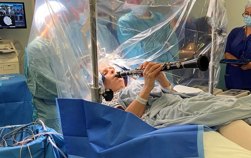 O femeie a cântat la clarinet în timpul unei operații pe creier pentru Parkinson și a simțit imediat îmbunătățiri