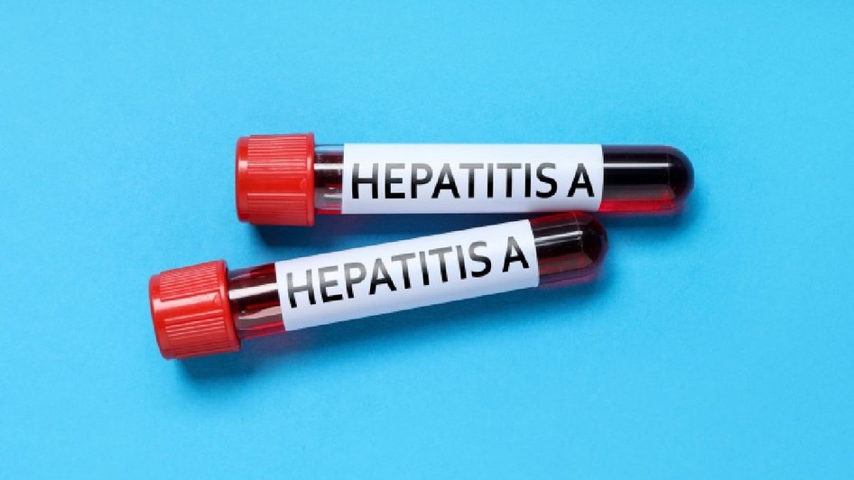 Focar de hepatita A la Brasov