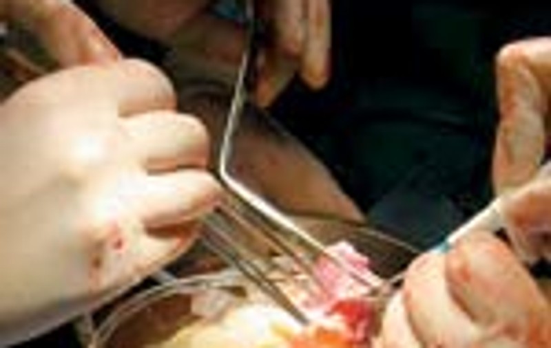 Transplant de personalitate?