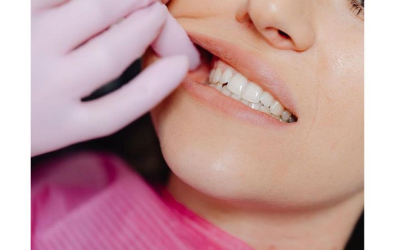 Semne că un dinte are nevoie de tratament endodontic: durere, sensibilitate și inflamație