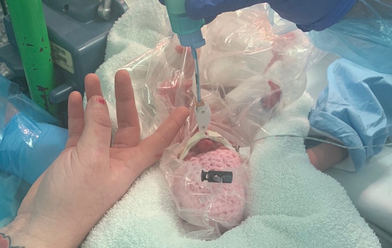 Un bebeluș născut prematur în Marea Britanie, salvat de medici cu ajutorul unei pungi de sandvici