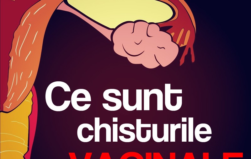 Ce sunt chisturile vaginale și cum le identifici