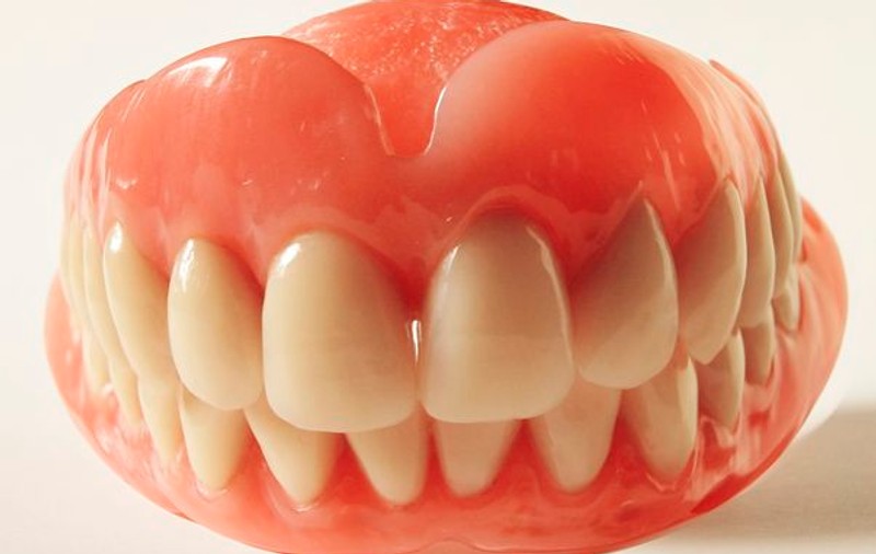 Proteză sau implant dentar?