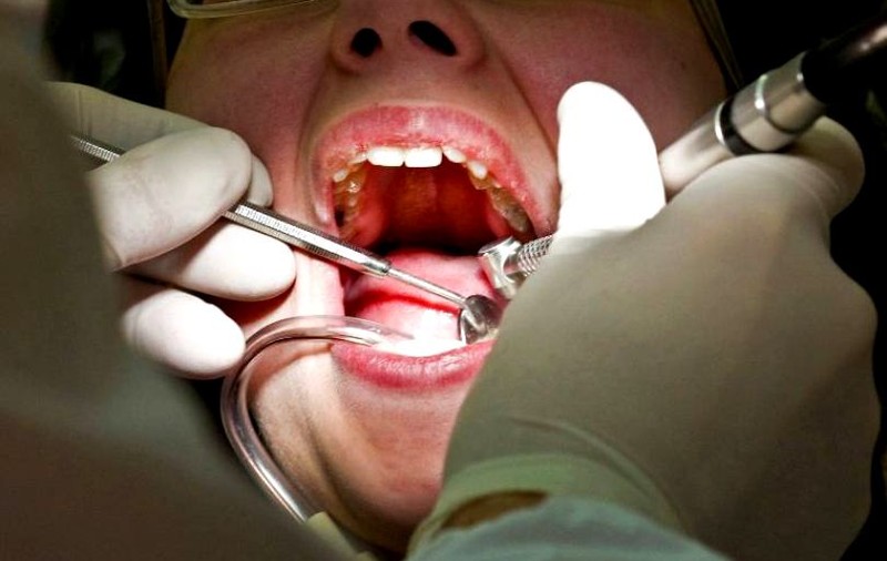 O româncă e supranumită dentistul „măcelar” în Franța. A fost condamnată după ce a mutilat zeci de pacienți