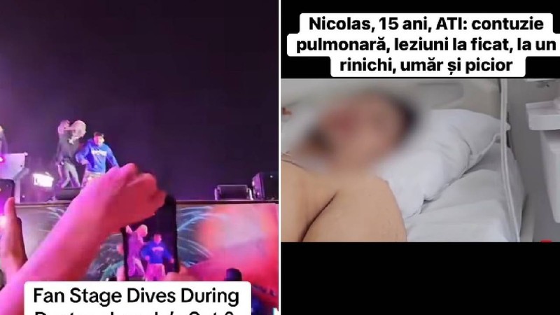 Adolescentul care a sărit de pe scenă la „Beach, Please!”: „Am crezut că sunt ultimele clipe”. Are contuzii pulmonare și leziuni la ficat și rinichi Citeşte întreaga ştire: Adolescentul care a sărit de pe scenă la „Beach, Please!”: "Am crezut că sunt ultimele clipe". Are contuzii pulmonare și leziuni la ficat și rinichi Foto: captură Facebook