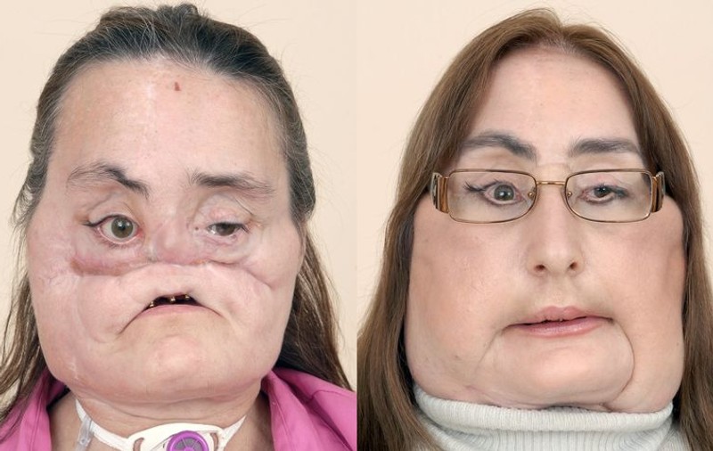 Esteticienii i-au redat viaţa