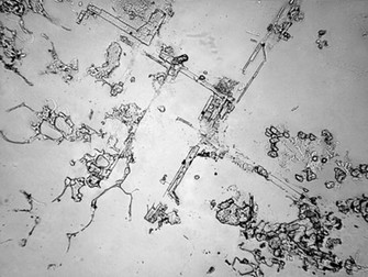 Așa arată lacrimile la microscop când plângem de durere (Foto: inbors.com)