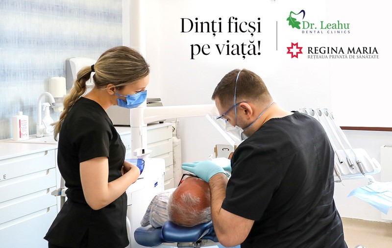 De ce să alegi dinți ficși pe viață?