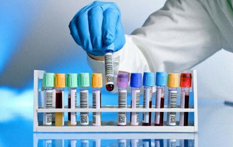 Ce sunt analizele medicale care se fac la angajare și de ce sunt necesare?