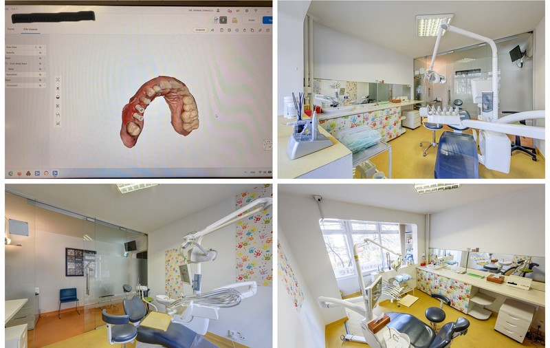 Dantură fixă pe implanturi în Sector 6: de ce pacienții din Drumul Taberei aleg dinți ficși la Dynamic Dental