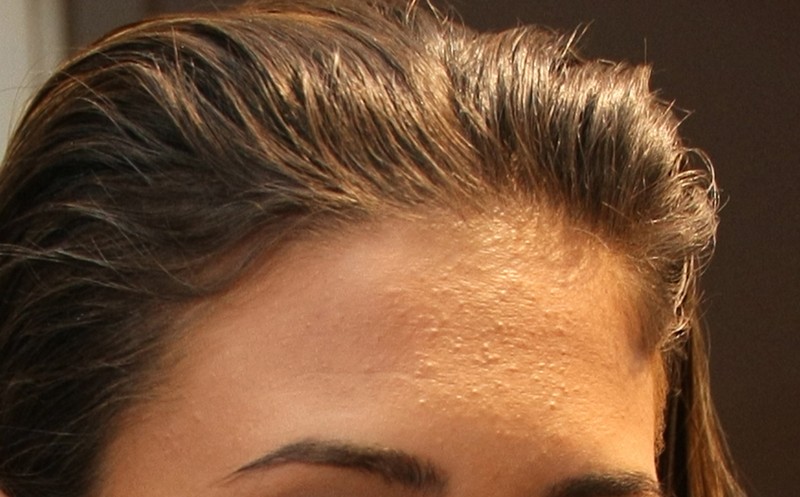 Arhiva foto