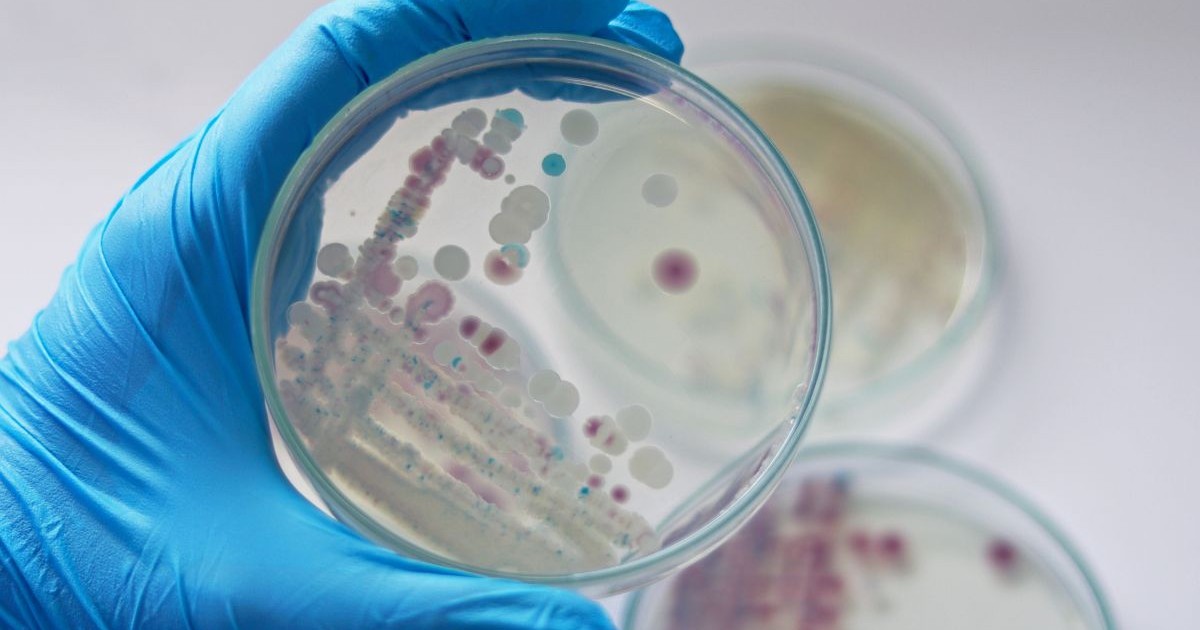 Un cercetător ține în mână o placă Petri cu Vibrio vulnificus pe medii CHROMagar și TCBS, o bacterie estuarină care se găsește în moluștele filtratoare, precum stridiile, în urma ingestiei bacteriei.