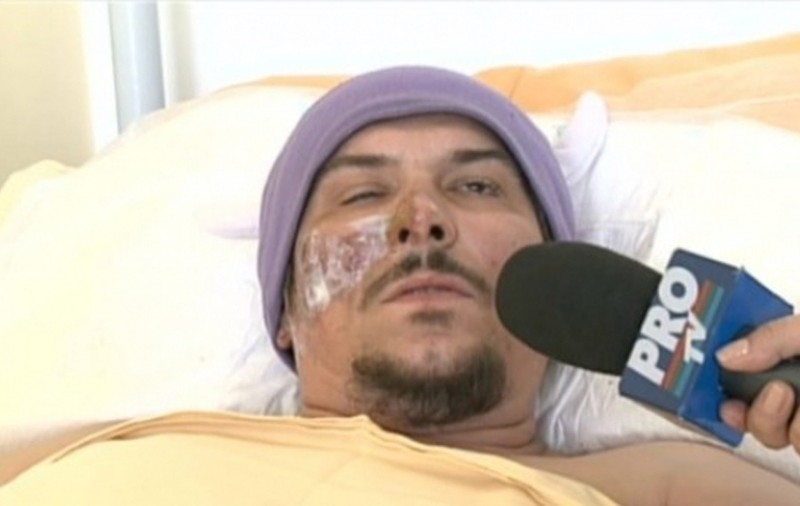 Declarații sfâșietoare de pe patul de spital! Ce spune basistul trupei Monarchy despre INFERNUL din Colectiv