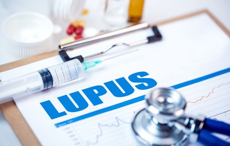 Cum recunoști simptomele de Lupus