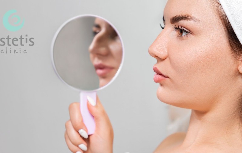 5 Lucruri interesante despre rinoplastie