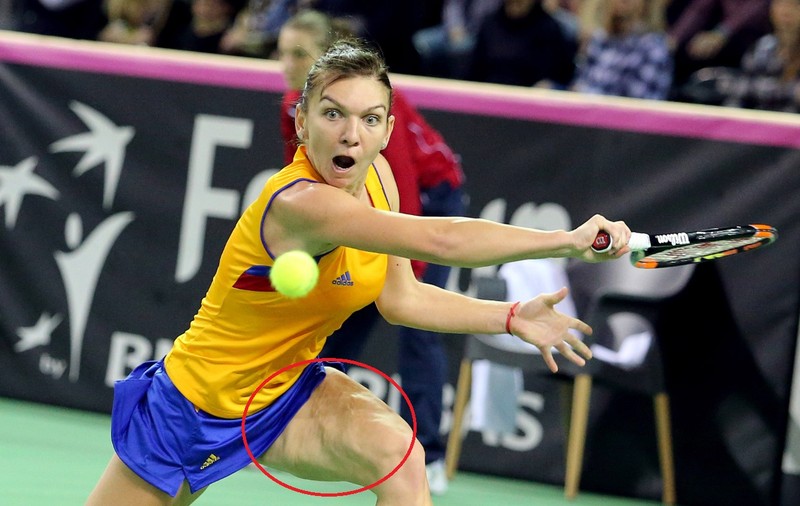 Imagine șocantă cu coapsa care o chinuie de doi ani pe Simona Halep. Dezvăluiri din tabăra echipei României de Fed Cup: ”Simona a plâns toată seara după meciul cu Pliskova. Înaintea partidei cu Kvitova, nu putea să meargă”