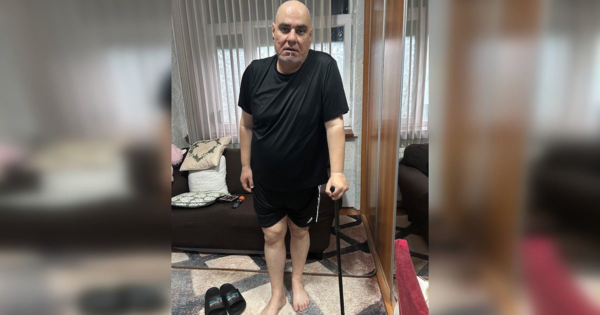 Operația la șold poate fi singura salvare a lui Petre ca să nu ajungă în scaunul cu rotile. Bărbatul care suferă de coxartroză bilaterală are nevoie de 10.000 de euro pentru intervenția chirurgicală de implantare a unor proteze