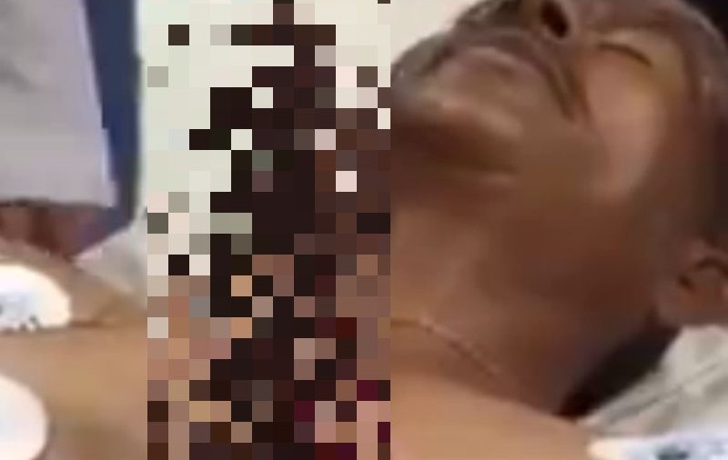 Şocant! Un bărbat a ajuns la spital cu un cuţit în piept. Ce se întâmplă când îi bate inima | VIDEO